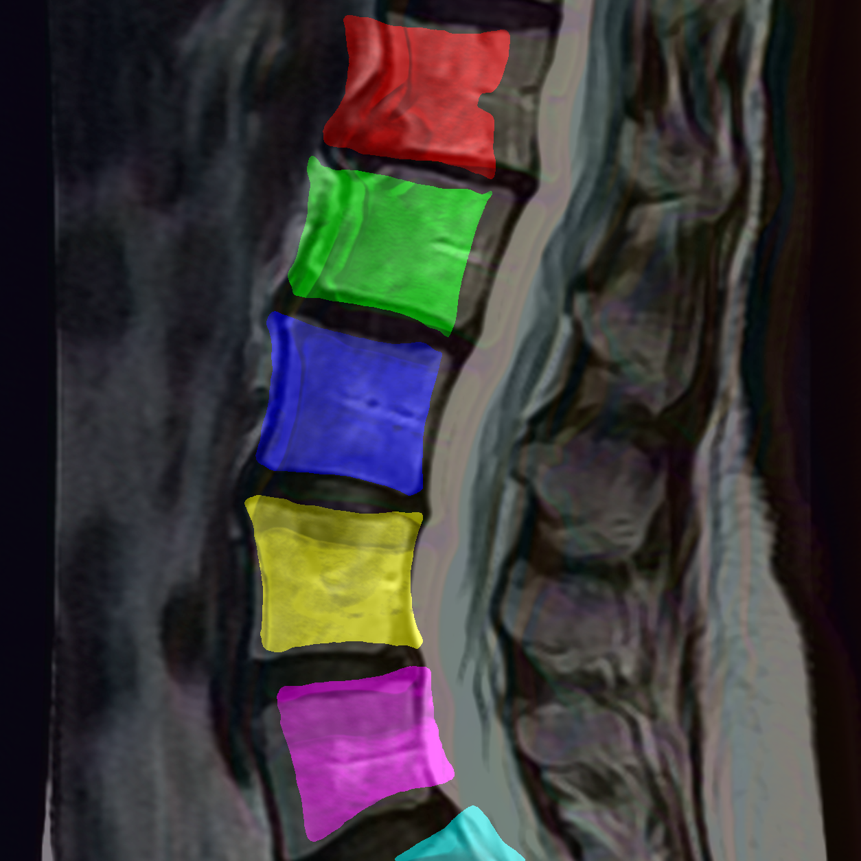 指定 RGB palette 的 normal-style 后处理图